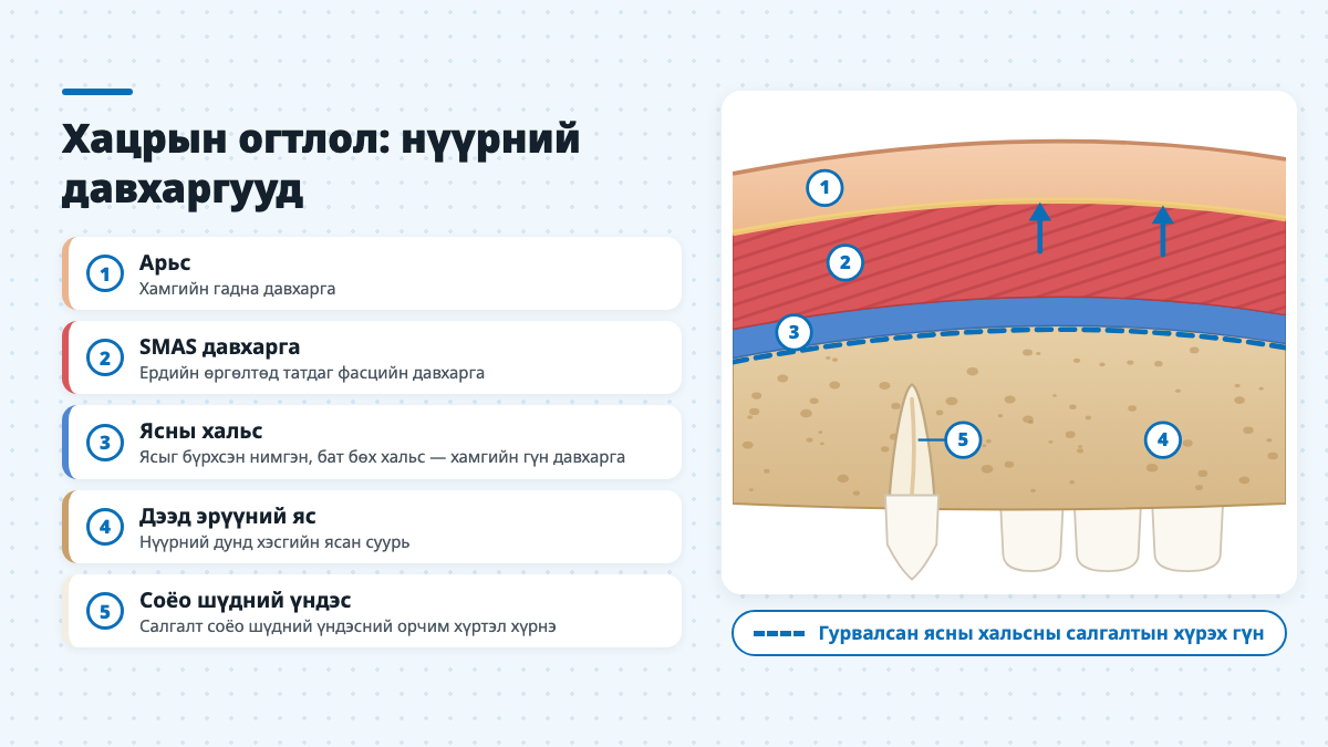 Арьс, SMAS давхарга, ясны хальс, дээд эрүүний яс, соёо шүдний үндсийг харуулсан хацрын огтлол